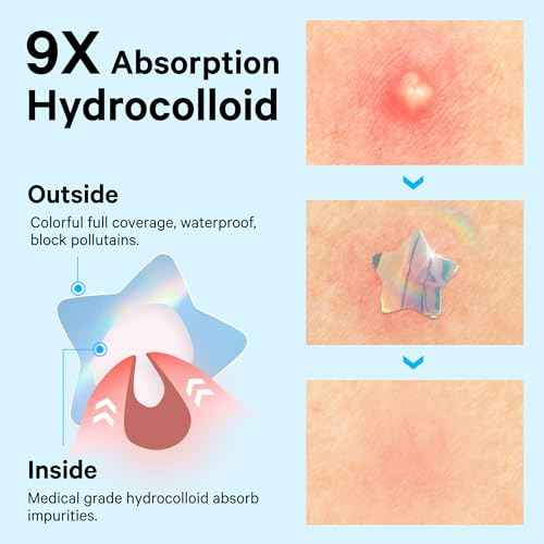 Sosky Hologram Pimple Patches for Face, Hydrocolloid Acne Patches with Salicylic Acid, Cute Star Zit Stickers,Colorful Blemish Covers,48 Count Blue Cloud