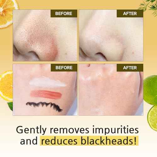 eyeNlip Calamansi Vita Cleansing Foam 4.23?fl?oz - Revitalizing Cleanser with Calamansi Extract, Centella & Hyaluronic Acid for Gentle Daily Care, Korean Skincare