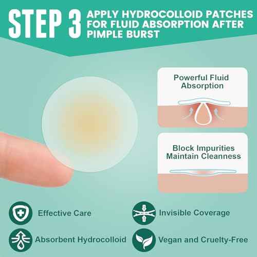 3-Step Microdart Pimple Patches Set ? 83 Count, including 9 Microdarts Pimple Patches, 50 Pimple Poppers, and 24 Hydrocolloid Patches