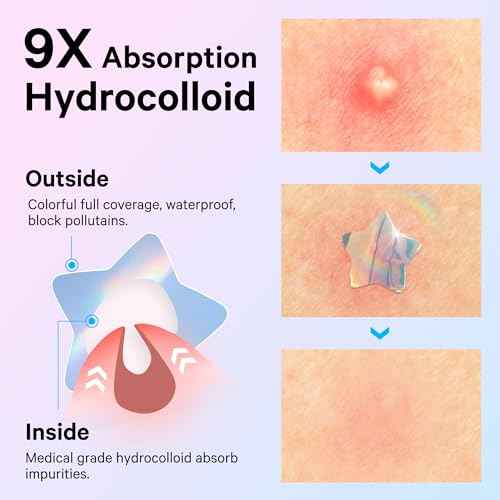 Sosky Hologram Pimple Patches for Face, Hydrocolloid Acne Patches with Salicylic Acid, Cute Star Zit Stickers,Colorful Blemish Covers,48 Count Blue Pink Star Heart Cloud Flower