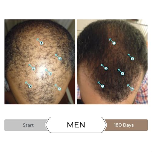 DS Labs Spectral Men's & Spectral Booster, Hair Density Serum - Leave-In, Strengthening, Thickening, Minimize Shedding, 60mL, Packaging May Vary