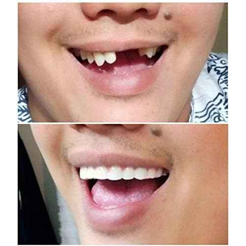 Instant Smile Comfort Fit Flex - Bright Shade - Upper Veneer Cosmetic Teeth