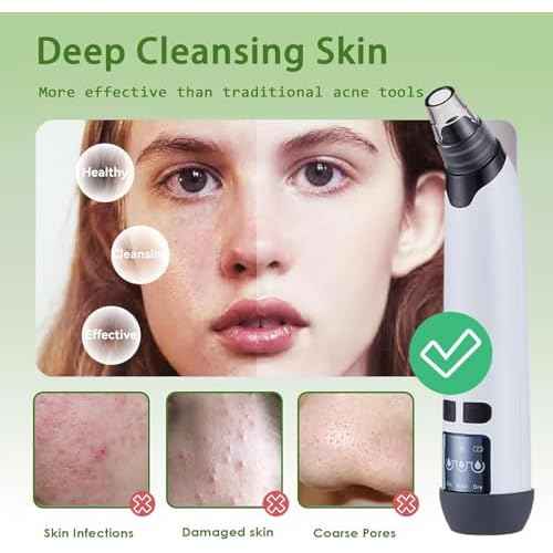 Blackhead Remover Pore Vacuum - Facial Pore Cleaner with 3 Adjustable Suction Levels, 4 Blackhead Removal Tools, Electric Acne Extractor Tool for Women & Men