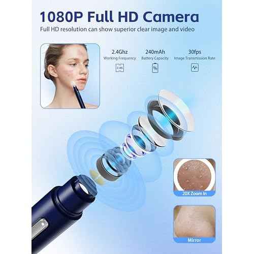 Visual Blackhead Remover Tools with Camera,Pimple Popper Extractor Tool Kit with Camera 20X 1080P Pore Cleaner Acne Comedone Whitehead Extractor Kit for iPhone/Android (Blue)