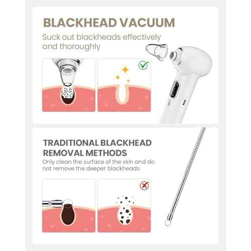 Pore Vacuum Blackhead Remover Kit - 5 Suction Heads & Extractor Tools, 3 Adjustable Suction Levels - Facial Pore Cleansing for Women&Men (White)