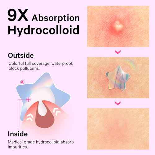 Sosky Hologram Pimple Patches for Face, Hydrocolloid Acne Patches with Salicylic Acid, Cute Star Zit Stickers,Colorful Blemish Covers,48 Count Pink Moon Flower
