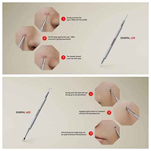 Suvorna Pimple Popper Tool Kit | Milia Remover | Lancets for Facial Extraction | White head Extractor Tool for Face | Comedone Extractor | Blackhead Remover tool | Acne Needle Tool & Cyst Removal Tool
