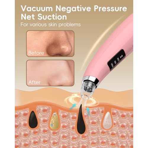 Blackhead Vacuum Removers - Pore Vacuum for Face with 5 Attachments & 3 Suction Levels - USB Rechargeable Blackhead Remover Tools for Women and Men (Matte Pink)