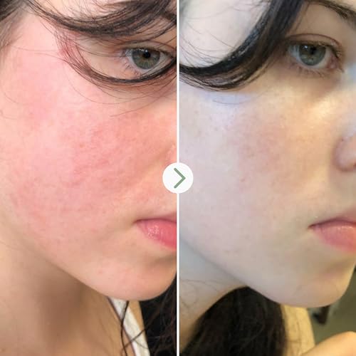 PAI SKINCARE - The Light Fantastic Organic Ceramide Face Oil | Natural, Vegan, Sensitive Skincare (1 fl oz | 30 mL)