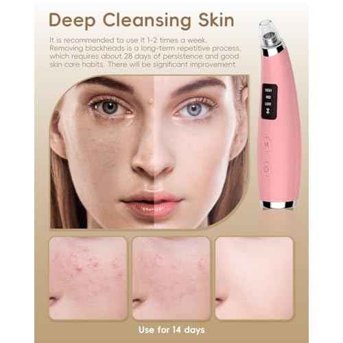 Blackhead Vacuum Removers - Pore Vacuum for Face with 5 Attachments & 3 Suction Levels - USB Rechargeable Blackhead Remover Tools for Women and Men (Matte Pink)