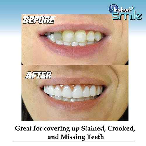 Instant Smile Comfort Fit Flex - Bright Shade - Upper Veneer Cosmetic Teeth
