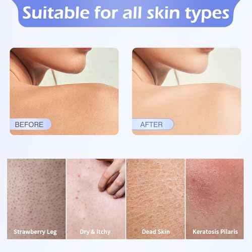 4 Pcs Round Exfoliating Glove, Skin Cleaner Silicone Exfoliator Polishing Mitt Body Scrubber Dead Skin Buffing Treatment for Shower Spa