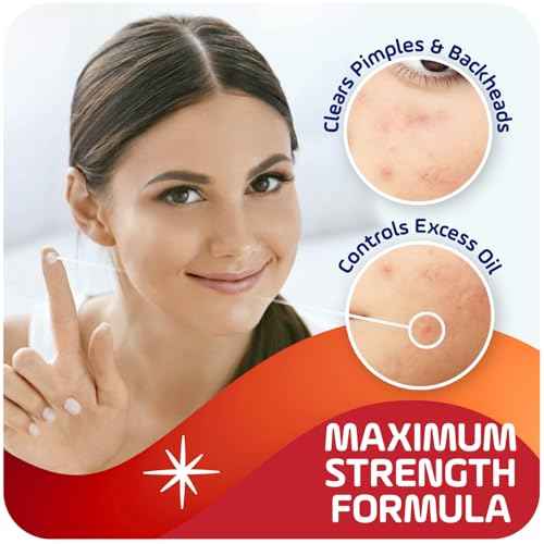 Asepxia 2% Salicylic Acid Acne Spot Treatment Cream | Drying Formula Targets Acne, Clears & Prevents Blemishes, Reduces Redness, Penetrates Pores, Pimple Cream, 1 Oz, 3-Pack