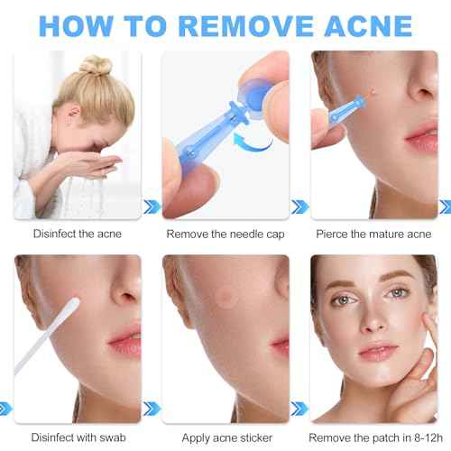 50PCS Disposable Acne Needle & 72 Dots Pimple Stickers - Ultrafine Pimple Popper Needle