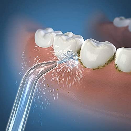 Replacement Classic Jet Tips Dental Water Jet Nozzle Accessories Compatible with Waterpik Water Flossers (Like WP-100) and Other Brand Oral Irrigators (9-Pack)