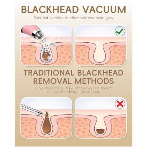 Blackhead Vacuum Removers - Pore Vacuum for Face with 5 Attachments & 3 Suction Levels - USB Rechargeable Blackhead Remover Tools for Women and Men (Matte Pink)