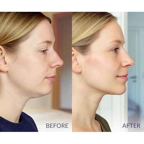 STYLIA V Line Lifting Collagen Mask - Lift, Firm & Contour Jawline - Tightening Double Chin Strap with Hyaluronic Acid & Aloe - Neck Lift & Face Tightening Mask - Jawline Shaper Face Lift Tape (10PC)
