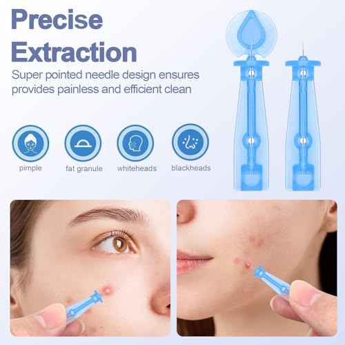 50 Pack Disposable Acne Pimple Popper Needles and 72 Dots Pimple Stickers, for Whitehead Acne Closed Mouth Needle (50 Pack)
