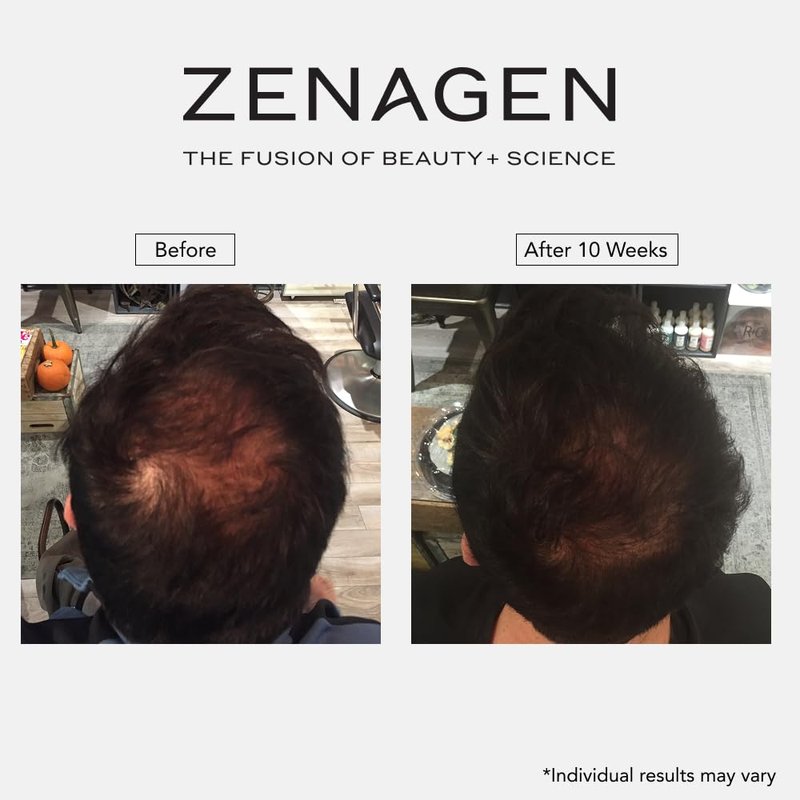 ZENAGEN Revolve Men's Thickening Shampoo | Supports Appearance of Fuller, Healthier-Looking Hair, Developed for Fine & Visibly Thinning Hair, Plant-Based, 5-Minute Treatment, 75 mL / 2.5 oz