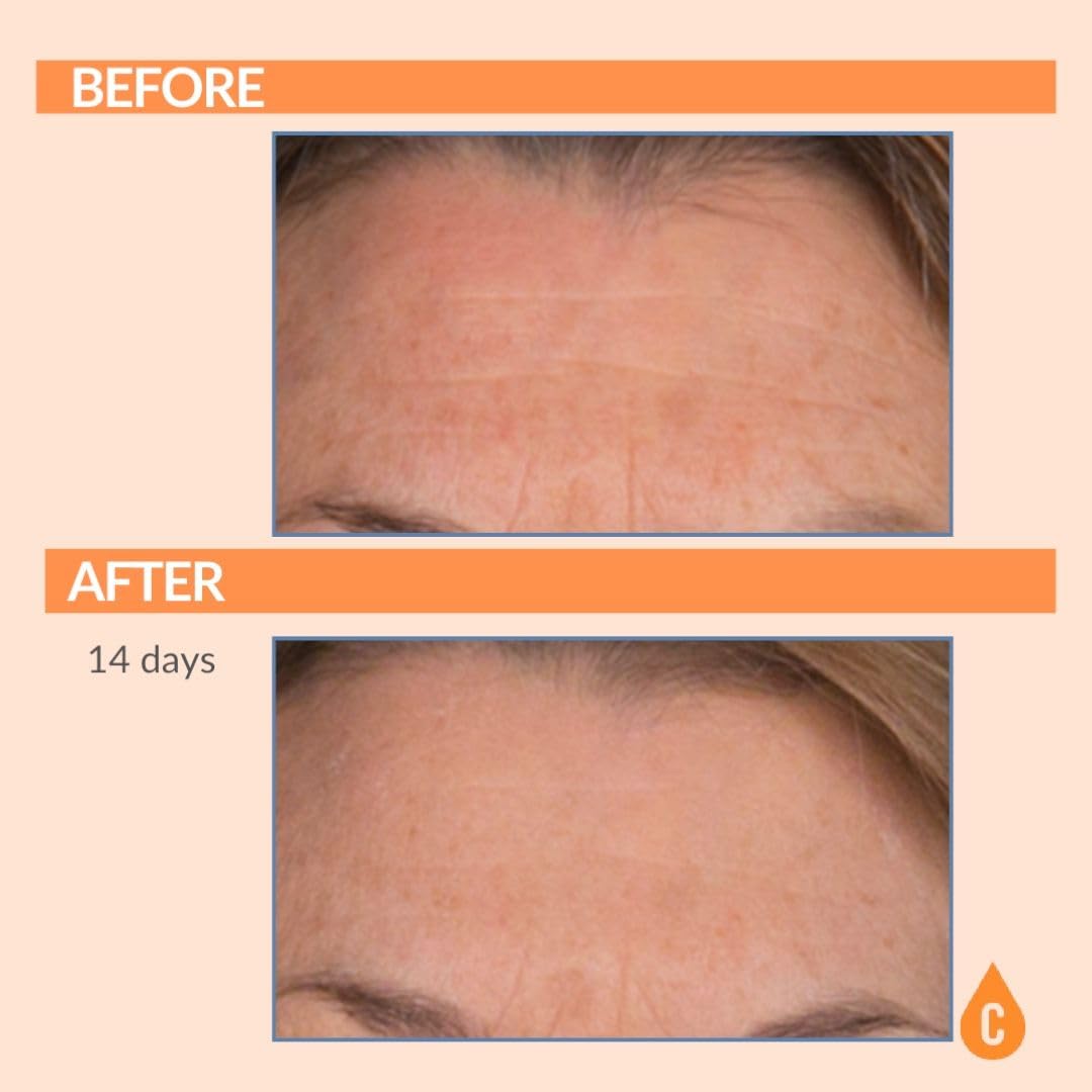 Serious Skincare - Vitamin C Broad Spectrum SPF 30 Sunscreen Moisturizer for Face, Hydrates Dry Skin, C3 Esters Anti-Aging Wrinkle Cream with Collagen, Radiant Skin, Daily Use, No White Cast 2 Fl. Oz.