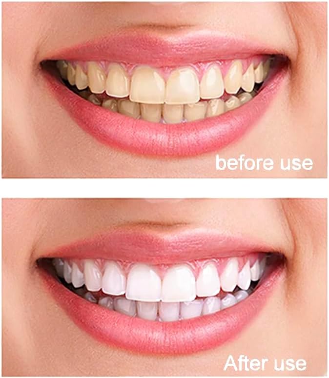 100% Pure Nano Hydroxyapatite Tooth Powder – Enamel Remineralization Support, Fluoride-Free Toothpaste Additive for Sensitivity & Cavity Defense, Pure HAp Powder 120 Grams