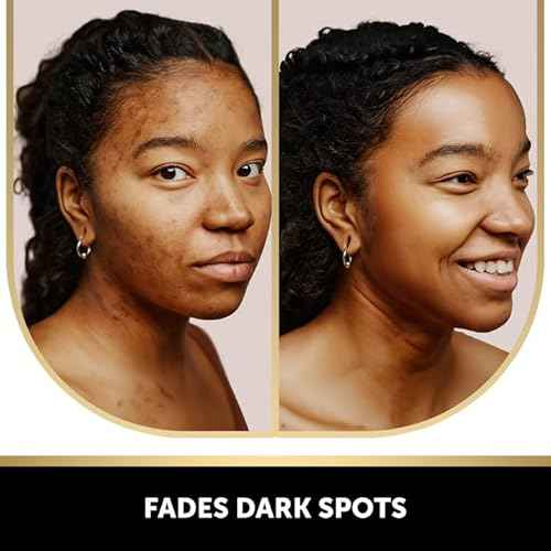 VALITIC Kojic Acid and Turmeric Dark Spot Corrector Soap ? Skin Care Cleansing Duo - 2 Soap Bars and 200 Melting Paper Sheets - Infused with Vitamin C, Retinol and Collagen