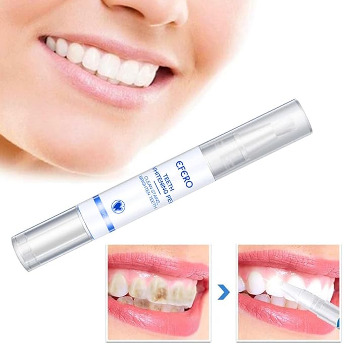 Teeth Whitening Teeth Whitening Gel Pen Essence for Tooth Instant Polish White Style1, Pen