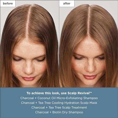 Briogeo Scalp Revival Charcoal + Tea Tree Scalp Treatment, Scalp Serum to Soothe a Dry, Flaky, Itchy Scalp, Absorb Oil, Hydrate Dry Scalp, Clarify Build Up, Vegan, Cruelty-Free, 1 fl oz