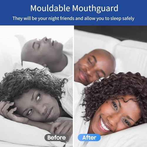 Mouth Guard for Clenching Teeth at Night, Night Guards for Teeth Grinding, Mouth Guard for Grinding Teeth at Night, Reusable Teeth Grinding Mouth Guard, Mouthguards for Grinding of Teeth (4 Piece Set)