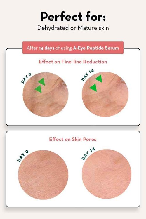 Sonage A-Eye Peptide Serum: for Dark Circles, Puffiness, Under Eye Bags, Wrinkles & Fine Lines | Anti-aging Serum for Eyes