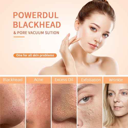 2025 Pore Vacuum, USB Rechargeable Blackhead Remover Vacuum,3 Levels Adjustable Pore Vacuum Blackhead Remover, with 5 Suction Power,6 Probes,Face Vacuum Pore Cleanser for Women & Men-White