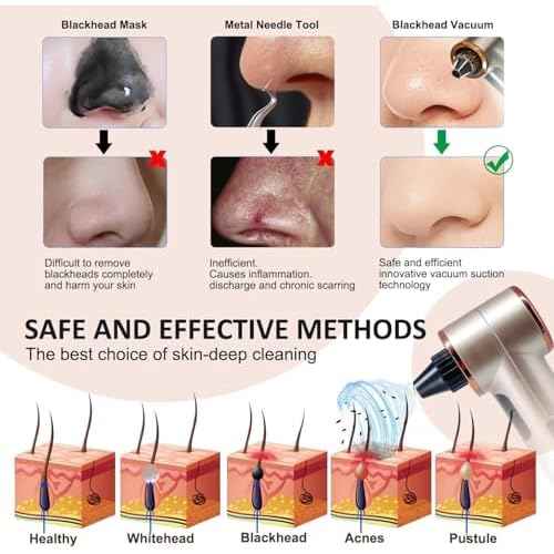 Blackhead Remover Vacuum with Heating, Blackhead Extractor 3 Adjustable Suction Levels 9 Modes, Pore Vacuum Blackhead Suction Remover, Comedone Extractor Kit for Deep Pore Cleaning (Golden)