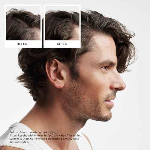 Nioxin Scalp + Hair Thickening System Kits | For Natural, Colored, & Damaged Hair with Light to Progressed Thinning | Strengthen & Boost Hair Density with Niacinamide & Biotin | 3 Month Supply