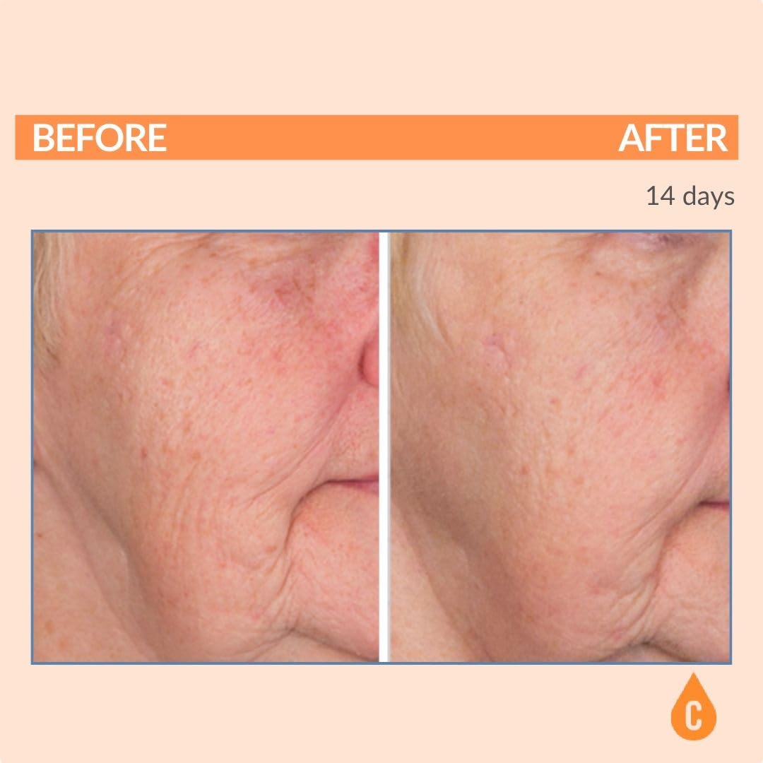 Serious Skincare - Vitamin C Broad Spectrum SPF 30 Sunscreen Moisturizer for Face, Hydrates Dry Skin, C3 Esters Anti-Aging Wrinkle Cream with Collagen, Radiant Skin, Daily Use, No White Cast 2 Fl. Oz.