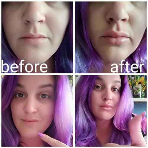 Generic Lip Enhancer Plumper Device,lip plumper device,fish lip plumper,Natural Pout Mouth Beauty Tool With Fish Design,Silicone Filler Plumper For Sexy Mouth, Natural Pout For Girls And Women, Red