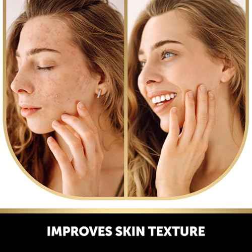 VALITIC Kojic Acid and Turmeric Dark Spot Corrector Soap ? Skin Care Cleansing Duo - 2 Soap Bars and 200 Melting Paper Sheets - Infused with Vitamin C, Retinol and Collagen