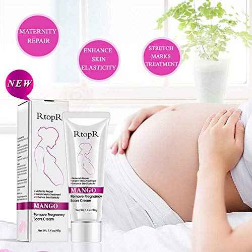 Mango Stretch Marks and Scar Cream, Stretch Mark and Scar Removal Cream for Pregnancy, Belly Creams for Wrinkles, Obesity Fat Marks Scars Moisturizing, Remove Marks (40g)