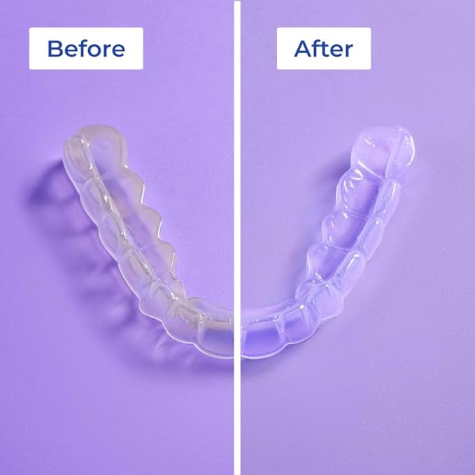 ALIGNER Cleaner Rinse | Concentrated | Clean aligners, retainers, dentures, Mouth Guards, Dental Appliance | 4 Month Supply, Alcohol Free, Minty & Fresh. Made in USA - Pack of 2 (33 fl.oz)