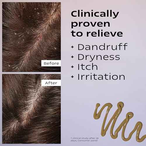 KAMEDIS Scalp Moisturizer Lotion For Dry, Itchy, Dandruff, Flaky, Seborrheic Dermatitis, Psoriasis and Sensitive Scalp. Over-Night Mask Treatment Botanicals-Based. Parabens Free. 3.38 Fl Oz.