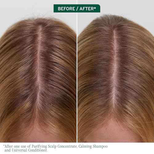 Biolage Scalp Sync Purifying Concentrate - Exfoliating & Clarifying Dry Scalp Treatment, Refreshing & Reinvigorating, Fermented Tea Blend & Glycolic Acid