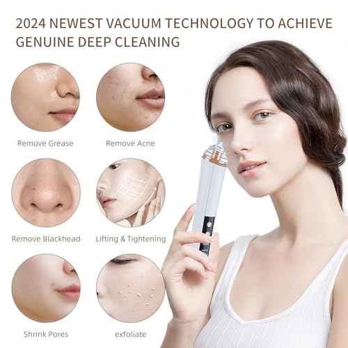 Blackhead Remover Pore Vacuum,Facial Pore Cleaner-6 Suction Power,3 Adjustable Suction Levels,USB Rechargeable Blackhead Vacuum Kit Electric Acne Extractor Tool for Women & Men (White)