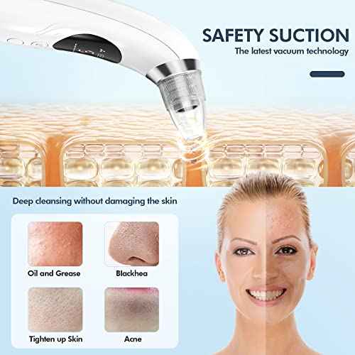 Blackhead Remover Pore Vacuum, Upgraded Black Head Remover for Face, Electric Acne Comedone Whitehead Extractor Tools-5 Suction Power, 5 Probes, USB Rechargeable Pimple Popper Tool Kit