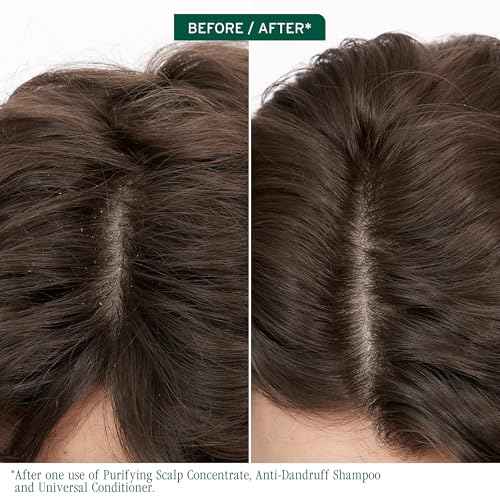 Biolage Scalp Sync Purifying Concentrate - Exfoliating & Clarifying Dry Scalp Treatment, Refreshing & Reinvigorating, Fermented Tea Blend & Glycolic Acid