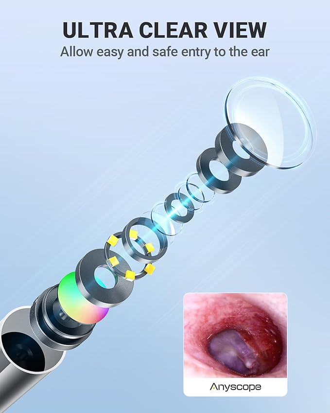Digital Otoscope Compatible with iPhone and Android Devices, HD Ear Camera with Ear Wax Removal Tools, Video Ear Scope Otoscope with Light, Capture Photos and Videos (Silver)