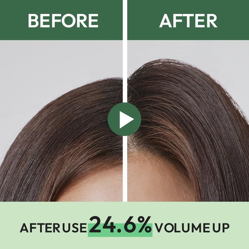 AMOS PROFESSIONAL The Green Tea Shampoo Refresh [For Oily Scalp] 17.6oz (500g) | Anti-Hair Loss Korean Hair Growth Shampoo for Cleanse Excess Sebum