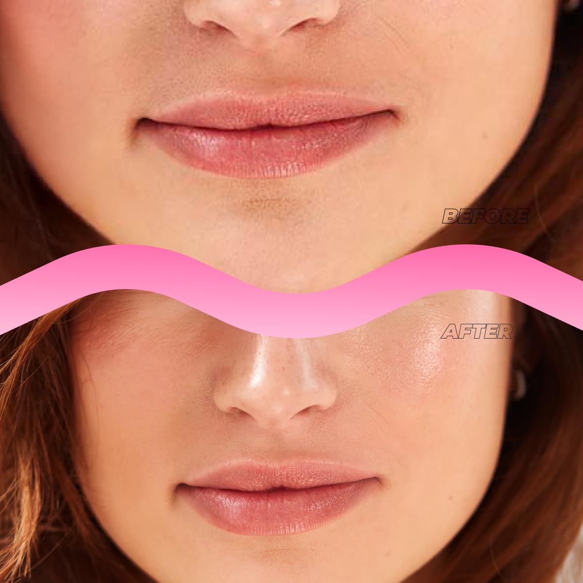 Instant Lip Filler Mask for Plumped Lips in 30 Mins with Vegan Collagen & Hyaluronic Acid - 3 Pack Korean Lip Mask Patches with 400 Dissolving Micro-Darts Tech for Instant & Long-Lasting Results