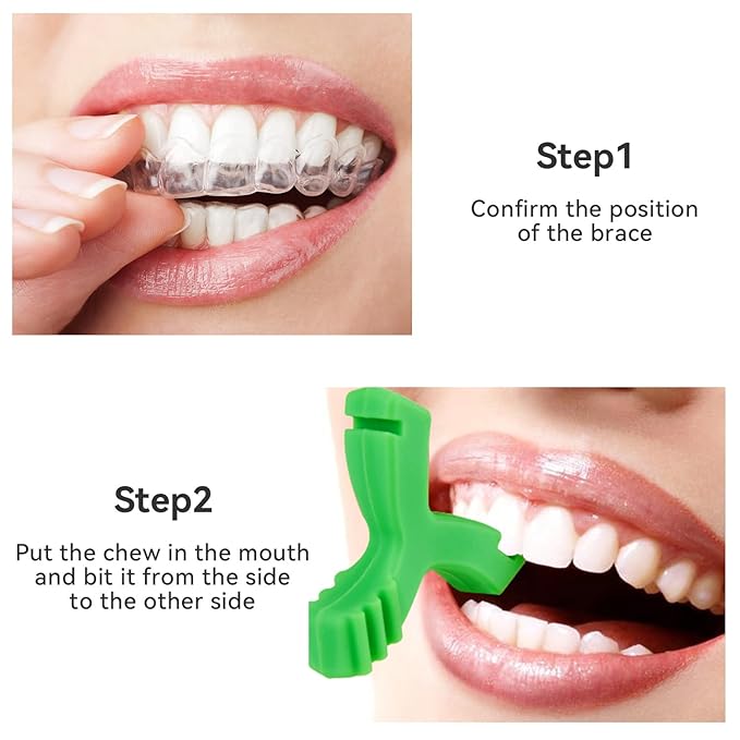 DLENP Y-Shaped Invisalign Chewies – Aligner Seater, BPA-Free Silicone, 4-Pack (2 Unscented + 2 Mint Scented)