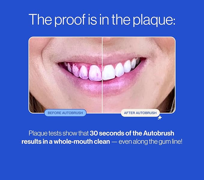 Autobrush Fluoride Foaming Toothpaste for Adults, Mint Flavor, Whitening & Deep Cleaning, Travel Friendly, Anti-Cavity (Pack of 1)