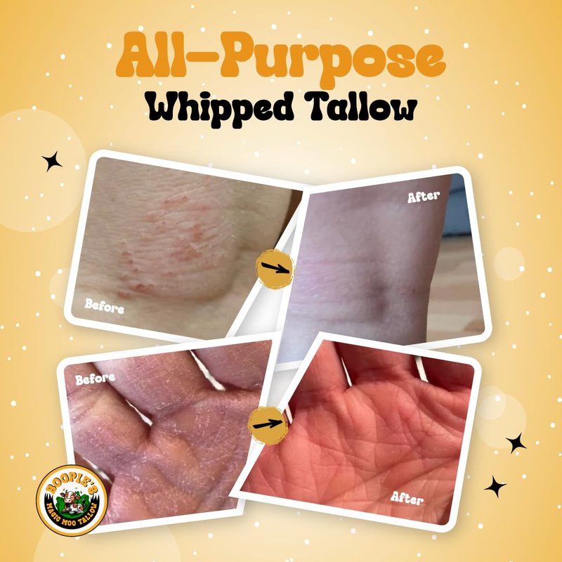 Magic Moo All Purpose Whipped Beef Tallow Skincare for Acne, Eczema, Dry Skin, Moisturizer, Stretch Marks & Hydration. Suet Tallow for Face with Organic Emu Oil. Contains All Organic Ingredients, 4oz