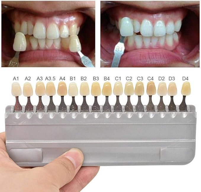 3D Teeth Whitening Shade Guide Porcelain - 16 Colors/Set Tooth Bleaching Shade Chart Mold - Tracking & Comparing - Dental Material Equipment - Oral Care
